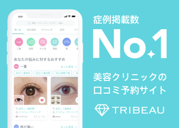 トリビュー
