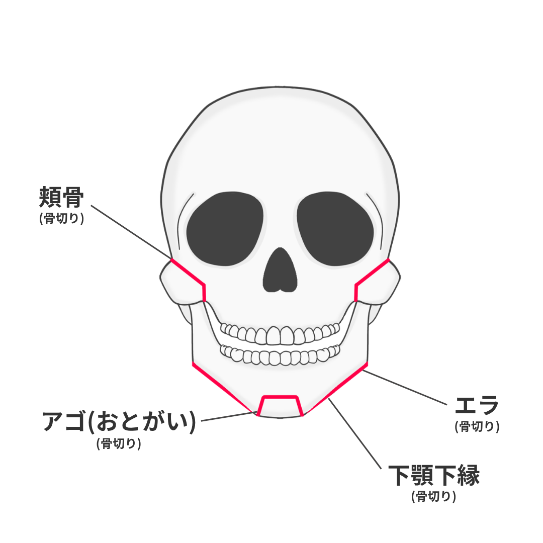 輪郭4点セット