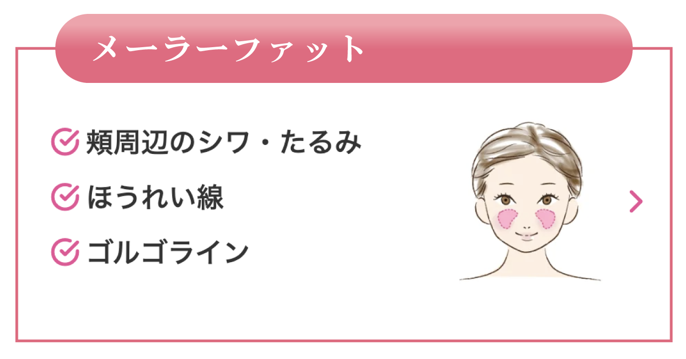 メーラーファット