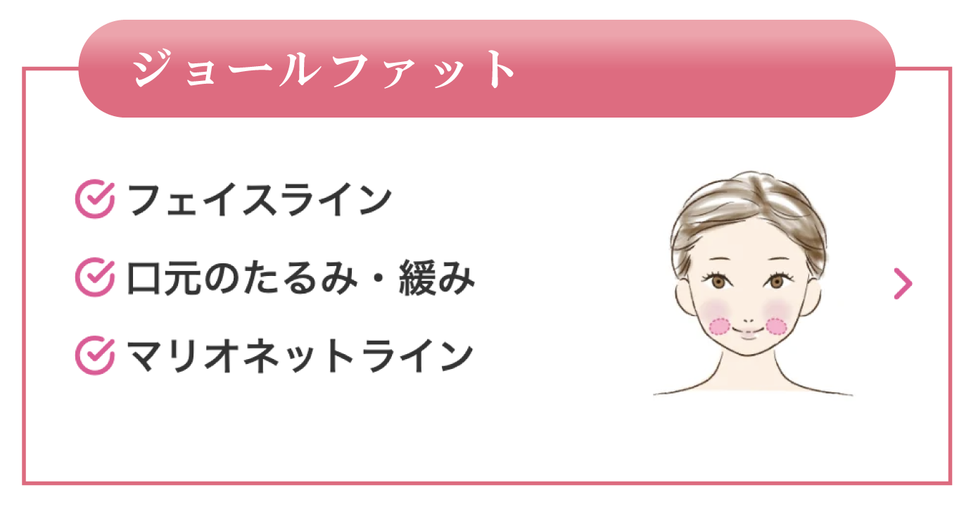 ジョールファット
