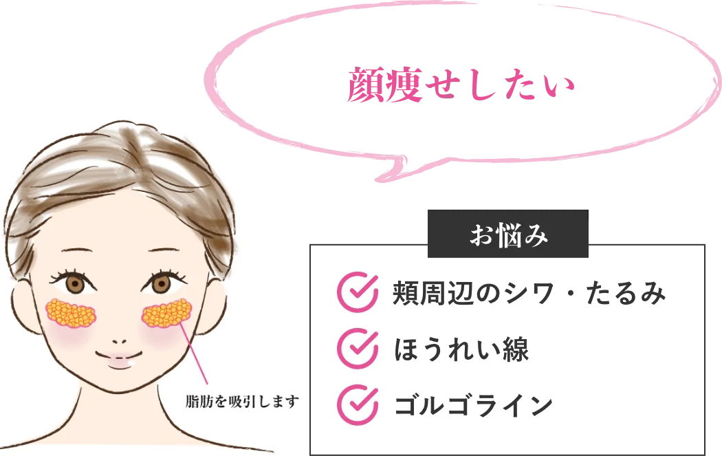 顔痩せしたい