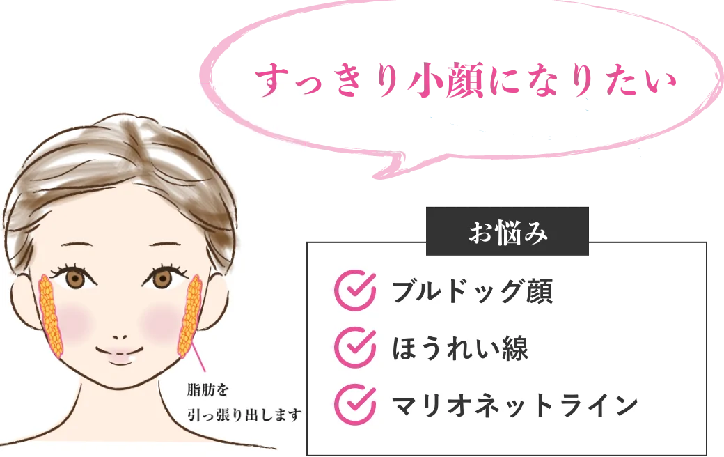 すっきり小顔になりたい