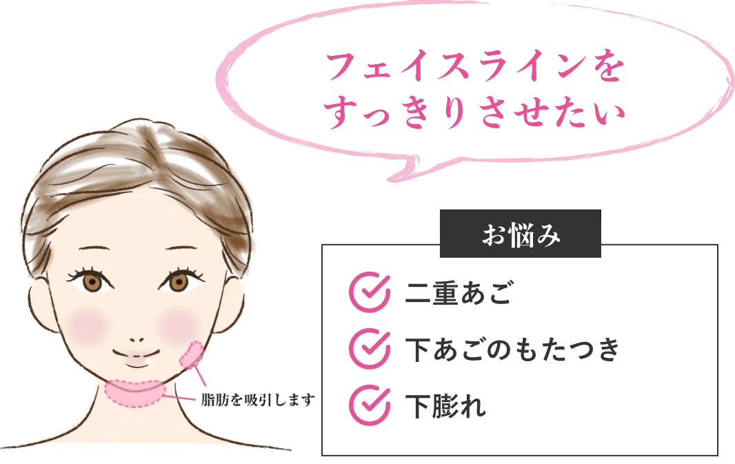 フェイスラインをすっきりさせたい