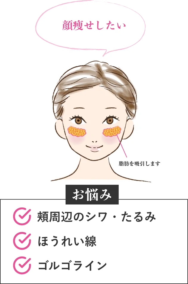 顔痩せしたい