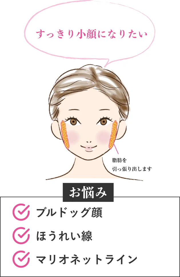 すっきり小顔になりたい