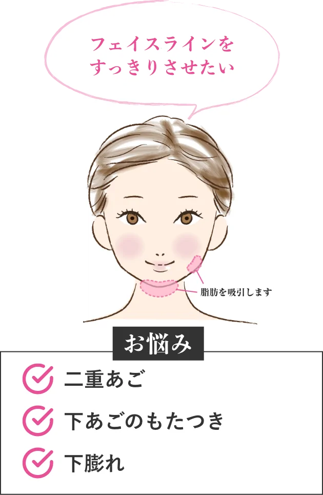 フェイスラインをすっきりさせたい