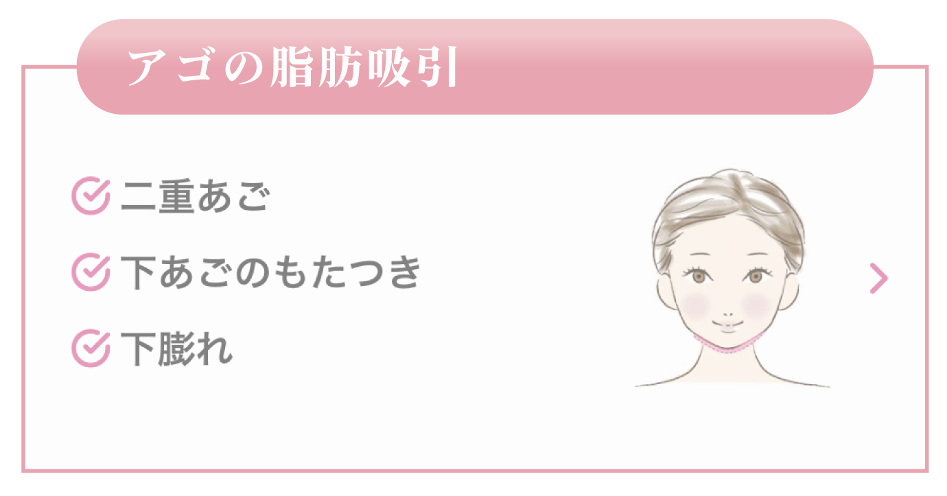 アゴの脂肪吸引